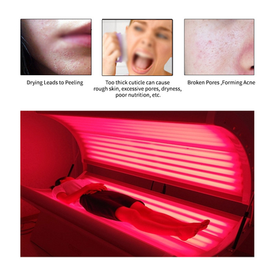 Camas ligeras rojas de la terapia del cuidado de piel 3.kw LED para el tratamiento del acné