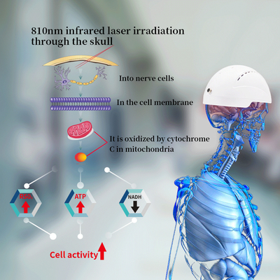 Casco médico de la fisioterapia de lesión de Brain Rehabilition Infrared Transcrial Neuron para la invitación de la depresión